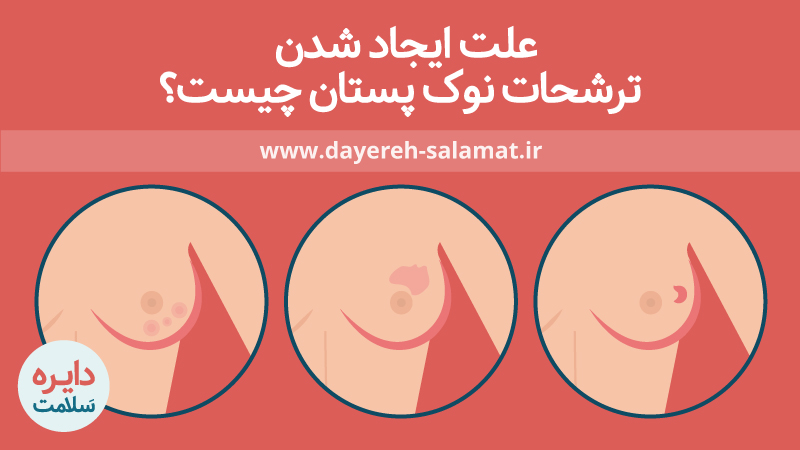 علت ترشحات نوک پستان 