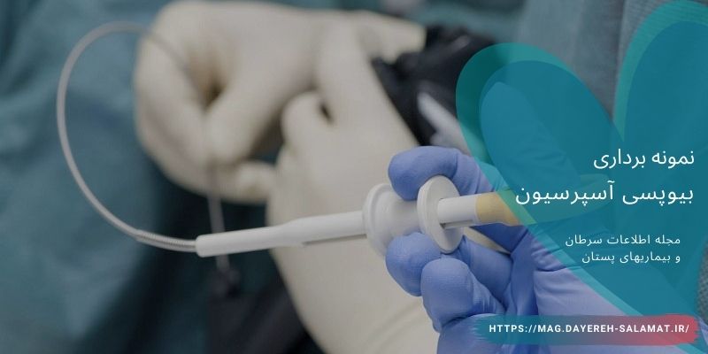 بیوپسی با روش آسپرسیون
