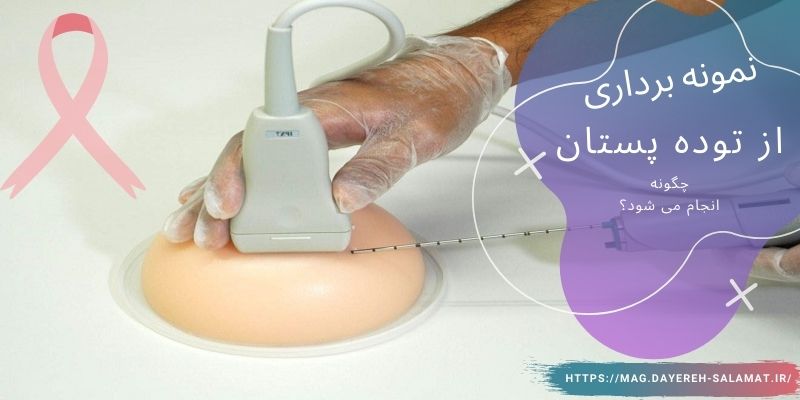 نمونه برداری از توده پستان