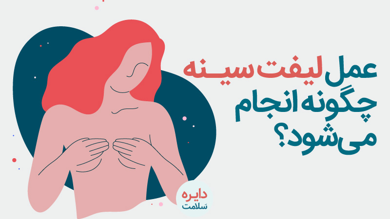 لیفت سینه