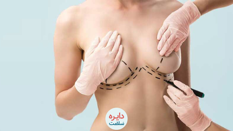 روش های لیفت سینه