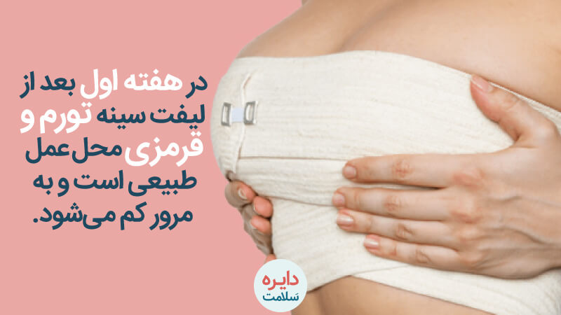 مراقبت بعد از عمل لیفت سینه